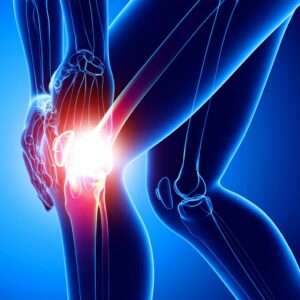 image douleur au genou de type entorse ligamentaire